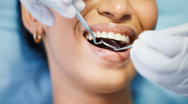 Best Emergency Dental Care for Sports Injuries in Nixon, PA